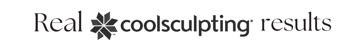 Real coolsculpting results (22)